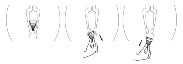 menstruační kalíšek